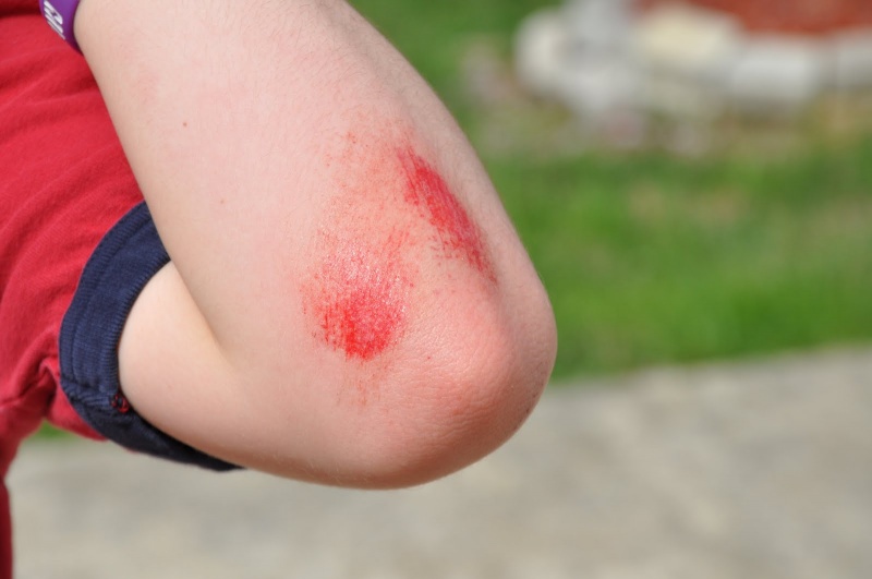 When Soap Meets Cuts and Bruises on Skin-15 Most Oddly Painful Things In The World