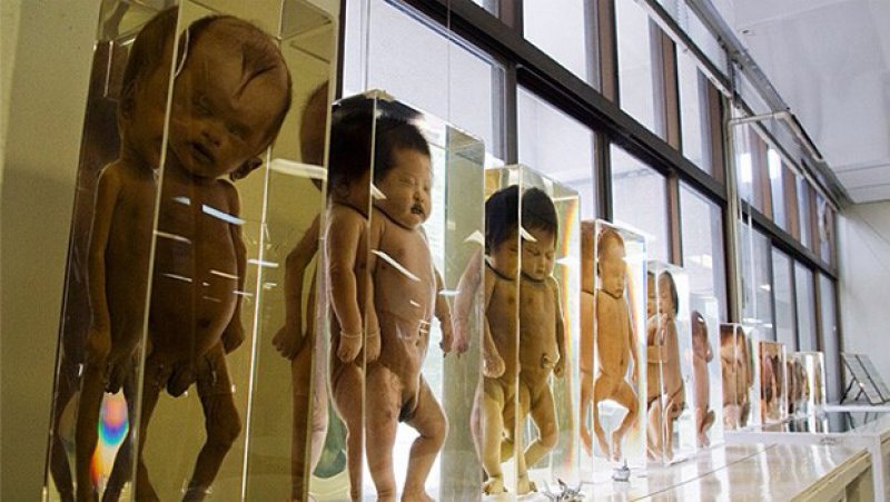 Siriraj Medical Museum, Bangkok -15 Weirdest Museums Around The World
