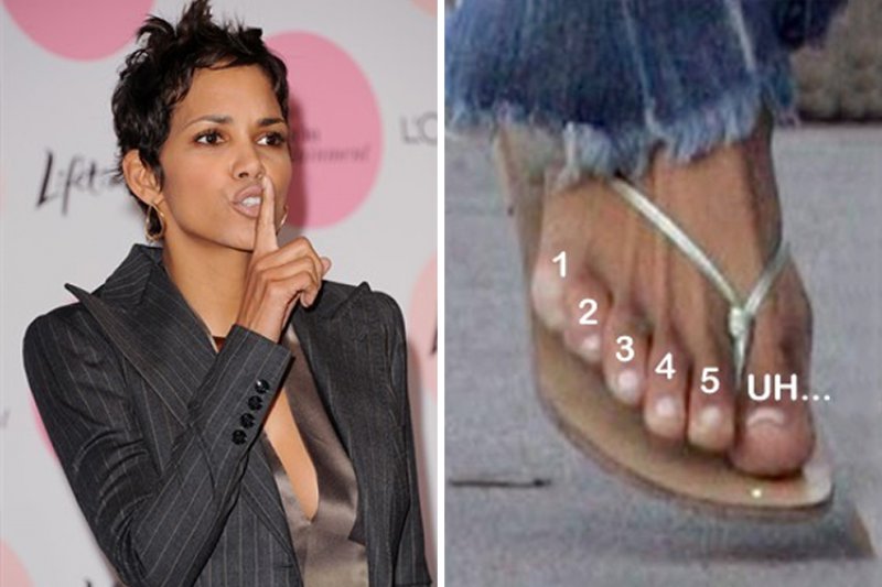 Halle Berry - Six Toes-15 Celebrities With Strange Physical Flaws You Probably Don't Know About