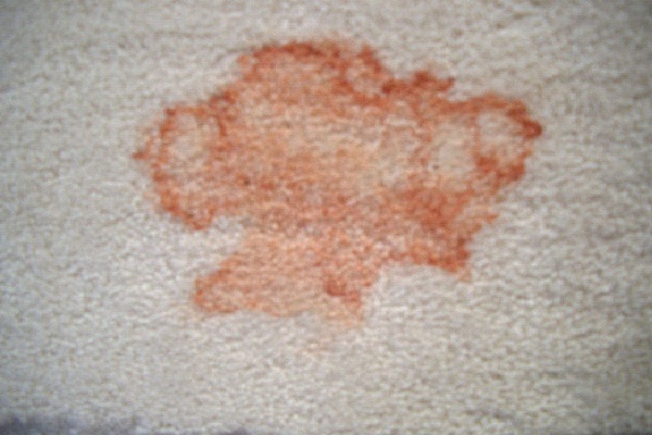 Removing Stains-Weird Uses Of Petroleum Jelly That You Didn't Know