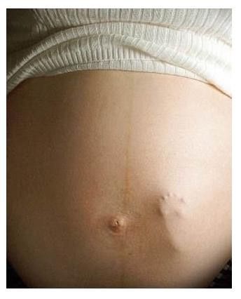 A strong fetus-Viral Photos That Turned Out To Be Fake