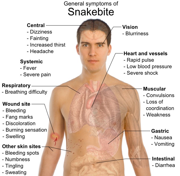 Snakebite-Emergency Life Saving Tips You Should Know