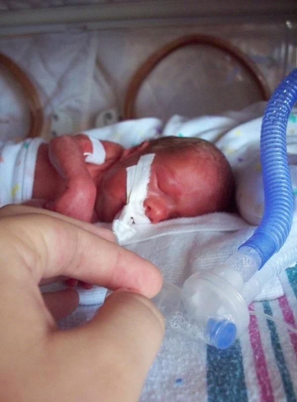 During Labor Your Baby's Heart Rate Will Drop-Things That Doctors Don't Tell You