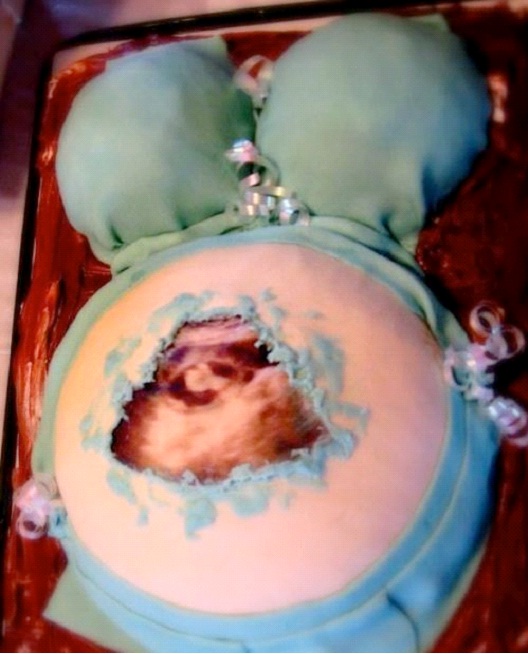 C-Section-Crazy And Offensive Cakes