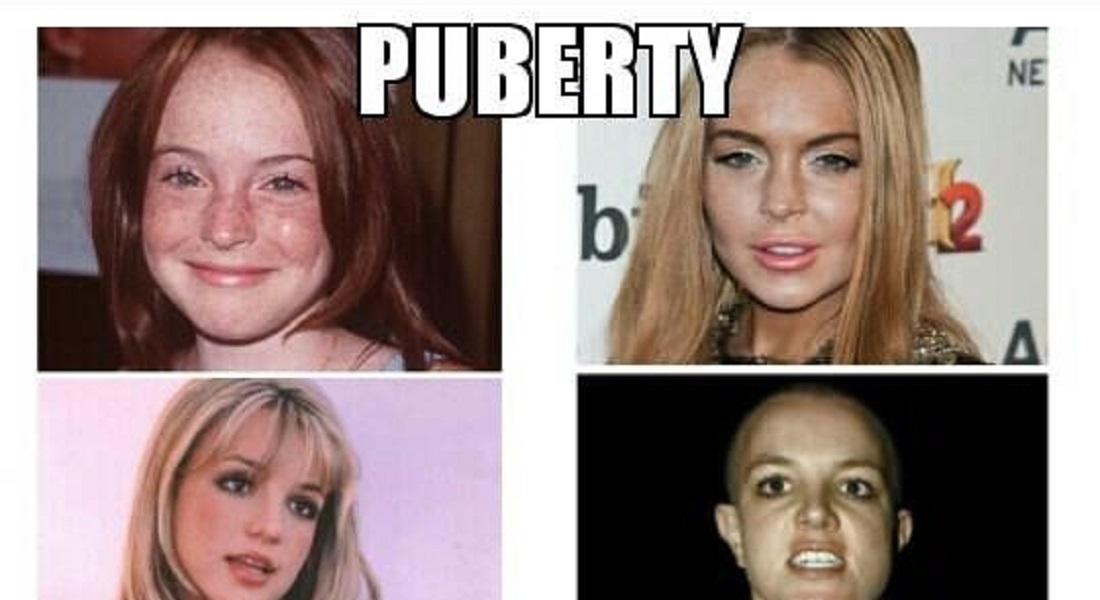 12 Photos That Show Puberty Doing It Wrong