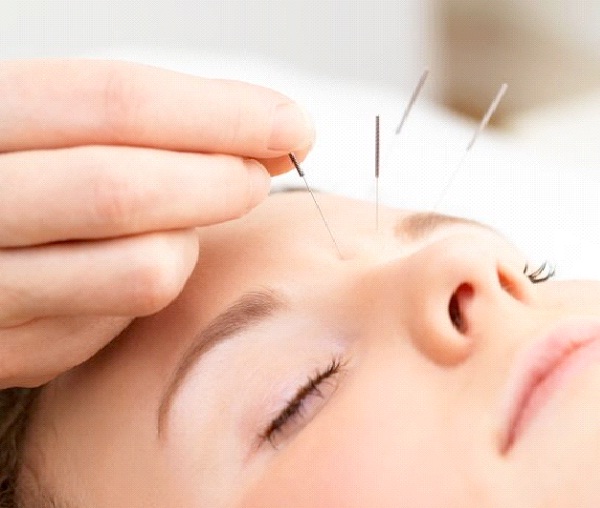 Try Acupuncture Or Hypnosis-How To Quit Smoking