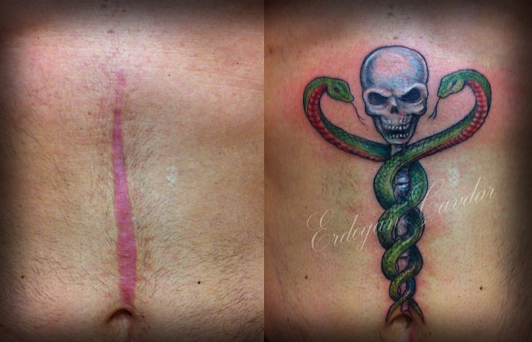 Any Scar-Best Tattoos To Cover A Scar