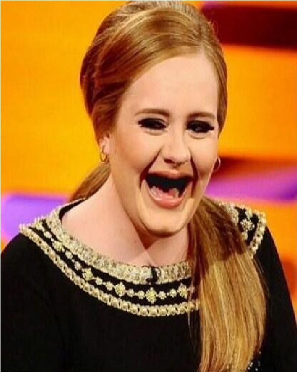 Adele-Celebs Without Teeth