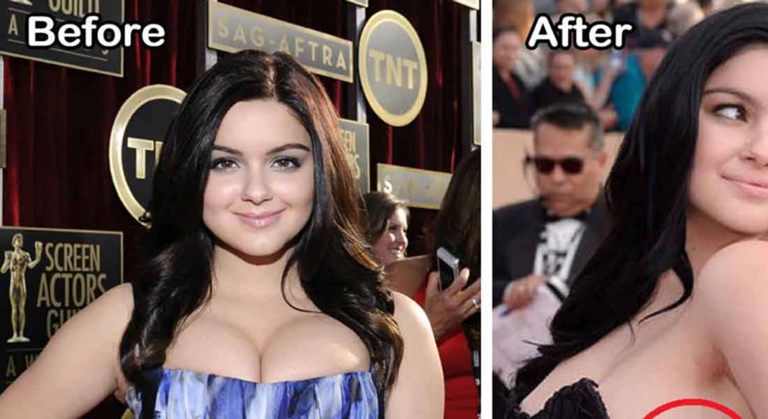 15 Celebrities Who Had Breast Reduction Surgeries