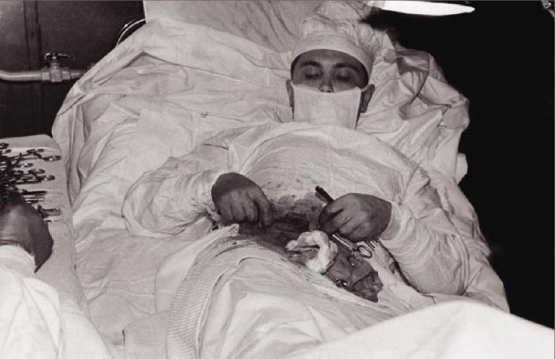 This Photo of a Doctor doing a Surgery on Himself-15 Images That Are Hard To Believe But Are Actually Real