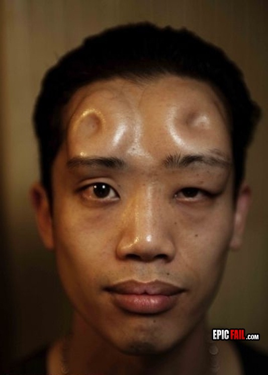 What is that in his head?-This Week's WTF Photos