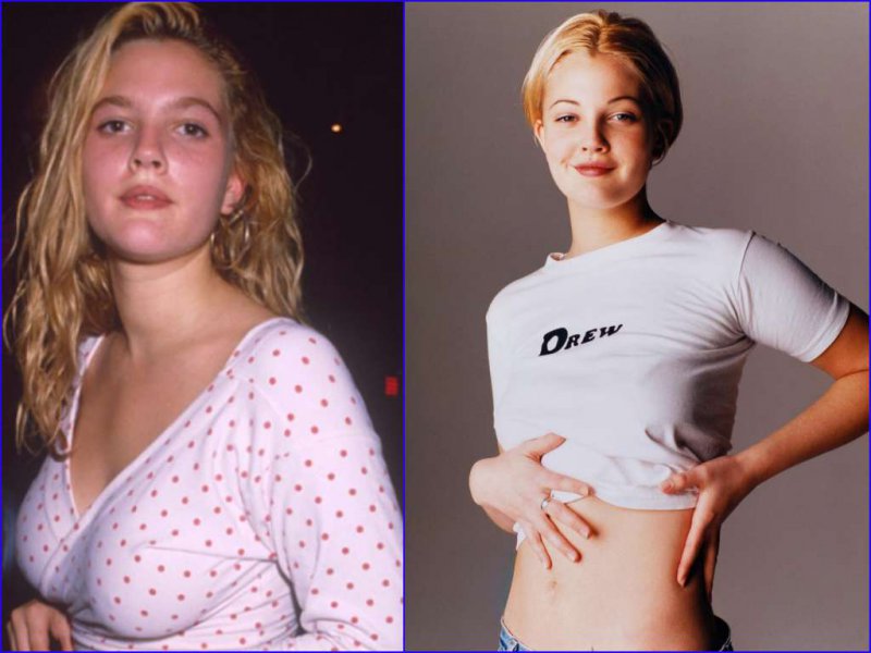 Drew Barrymore Before And After Breast Reduction Surgery-15 Celebrities Who Had Breast Reduction Surgeries