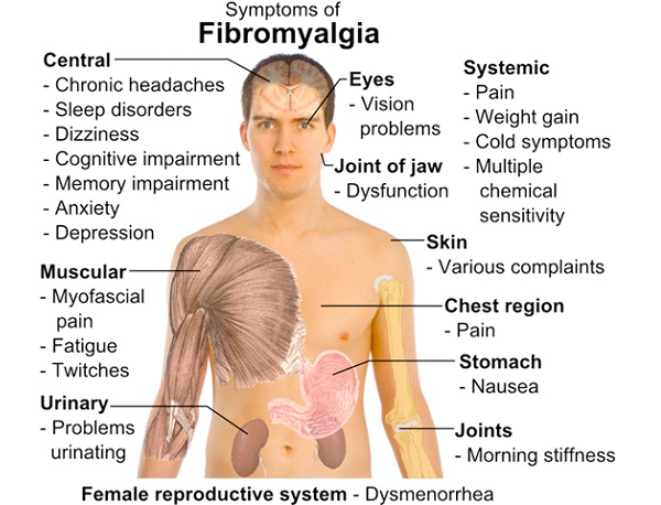 Fibromyalgia-Most Painful Diseases In The World