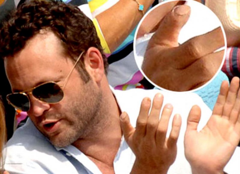 Vince Vaughn - Cut Thumb Tip-15 Celebrities With Strange Physical Flaws You Probably Don't Know About