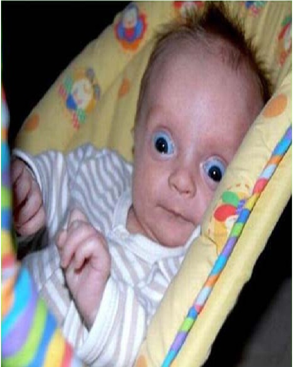 Crazy-Eyed Baby!-Craziest Baby Pics