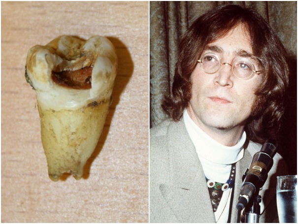 John Lennon's Tooth-Bizarre Celebrity Items Put Up For Auction