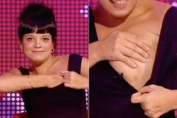 Lily Allen - Third Nipple-15 Celebrities With Strange Physical Flaws You Probably Don't Know About