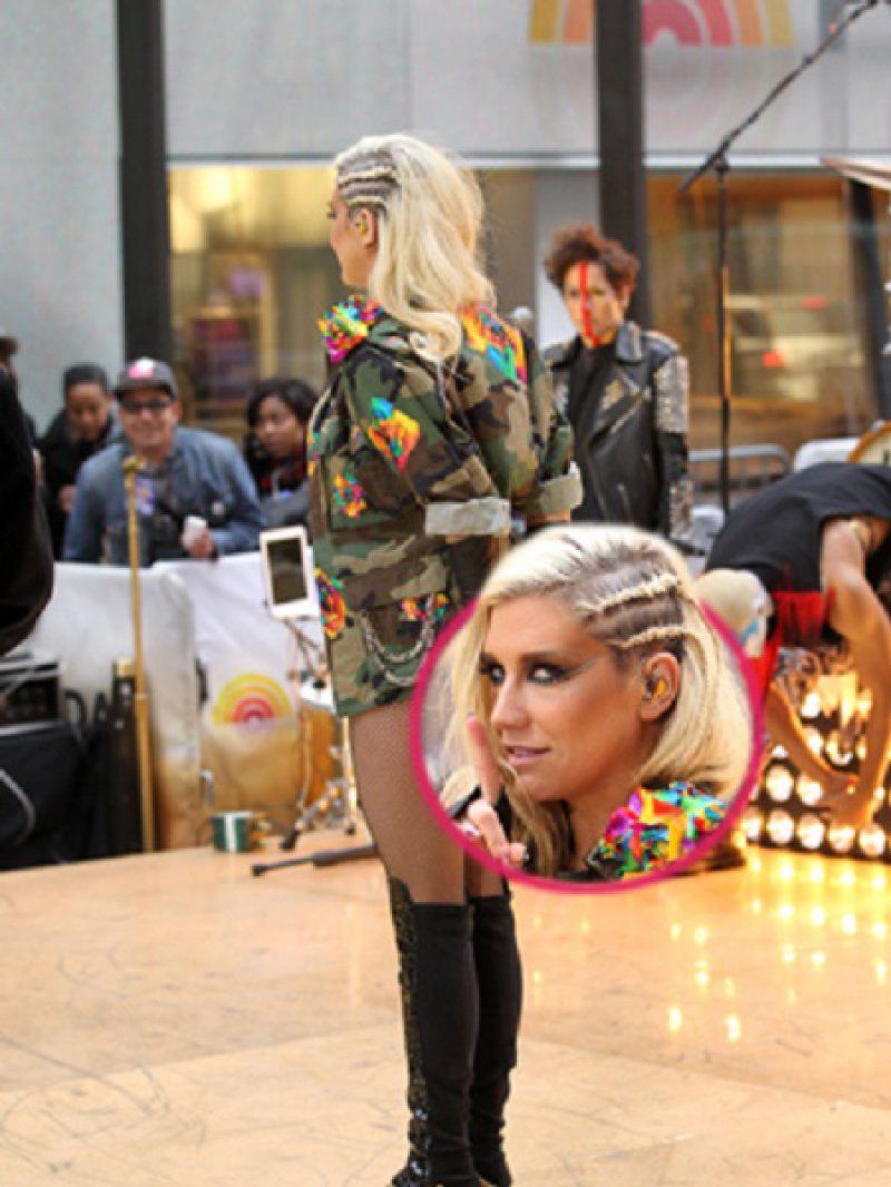 Kesha's vestigial tail-15 Celebrities With Strange Physical Flaws You Probably Don't Know About