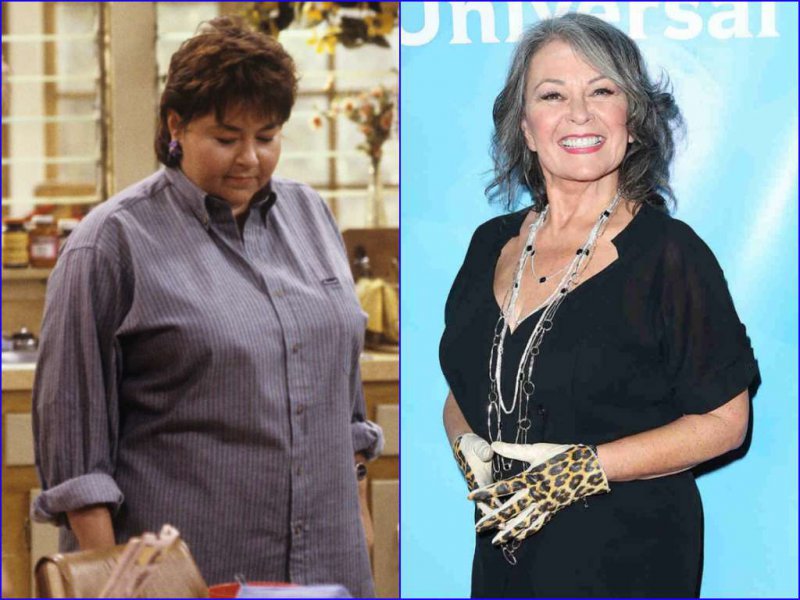 Roseanne Barr Before And After Breast Reduction Surgery-15 Celebrities Who Had Breast Reduction Surgeries