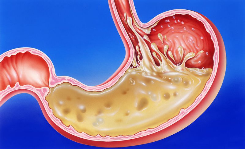 Your Gastric Juices-15 Disturbing Facts About Human Body That May Shock You