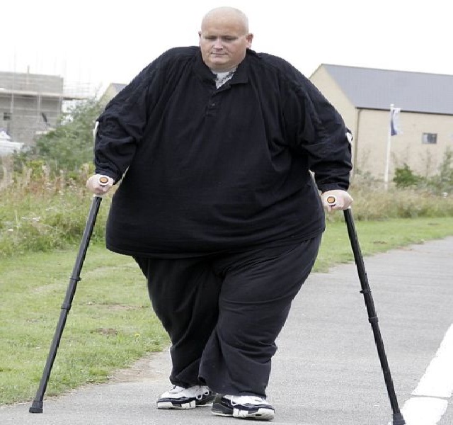 Walking-Transformation Photos Of The Fattest Man In The World