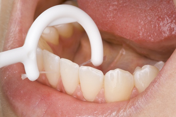 Flossing-Natural Ways To Keep Your Teeth Healthy