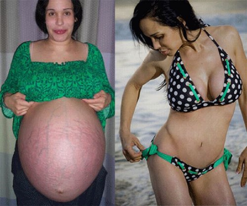 Natalie Suleman-12 World's Oddest Mothers Ever