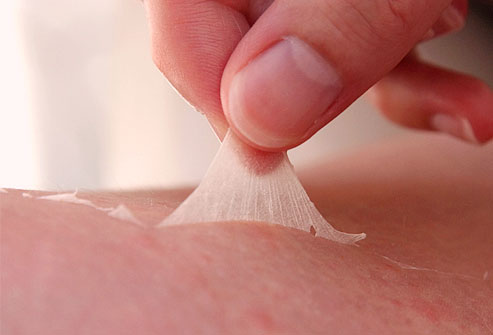 When You Accidentally Peel off More Skin than You Should-15 Most Oddly Painful Things In The World