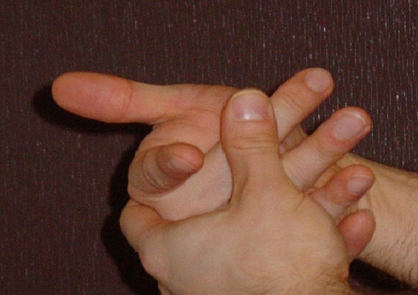 Cracking Knuckles Gives You Arthritis-Most Popular Myths Debunked
