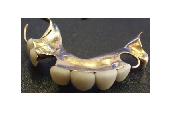 Churchill's Teeth-Bizarre And Insanely Expensive Auctions