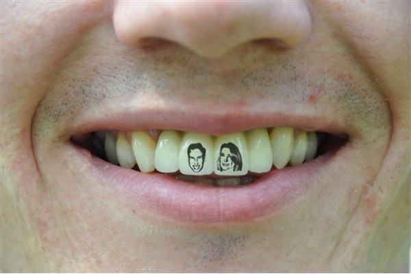 Your teeth-Craziest New Types Of Tattoos