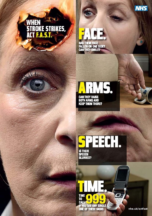 Stroke-Emergency Life Saving Tips You Should Know