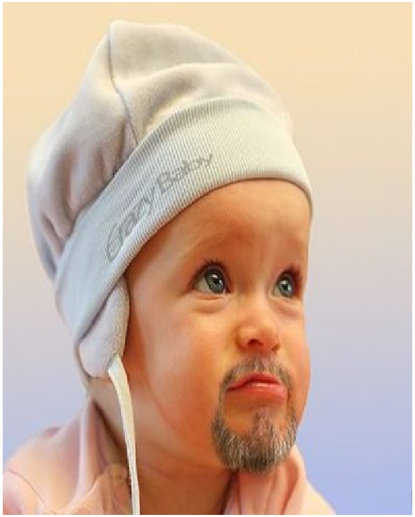 Benjamin Button Baby-Craziest Baby Pics