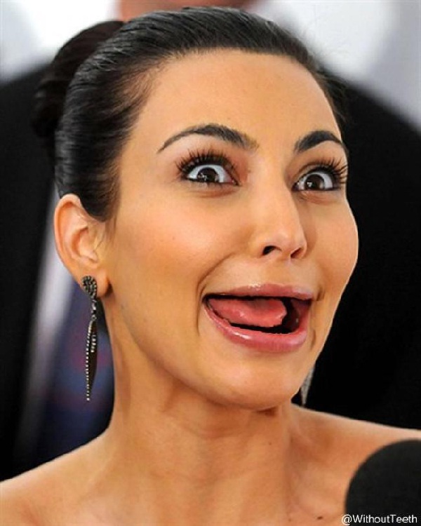 Kim Kardashian-Celebs Without Teeth
