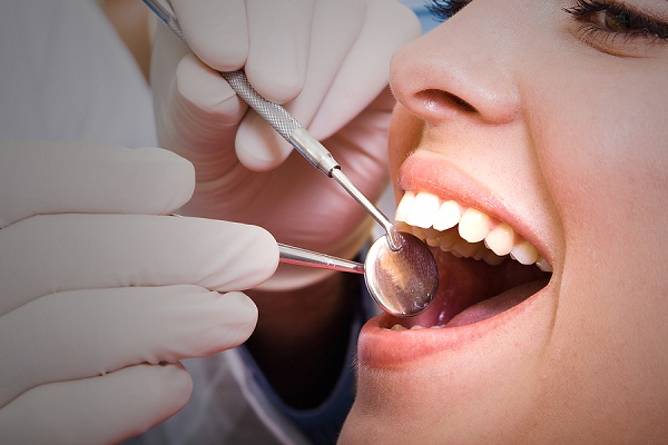 Checkups-Natural Ways To Keep Your Teeth Healthy