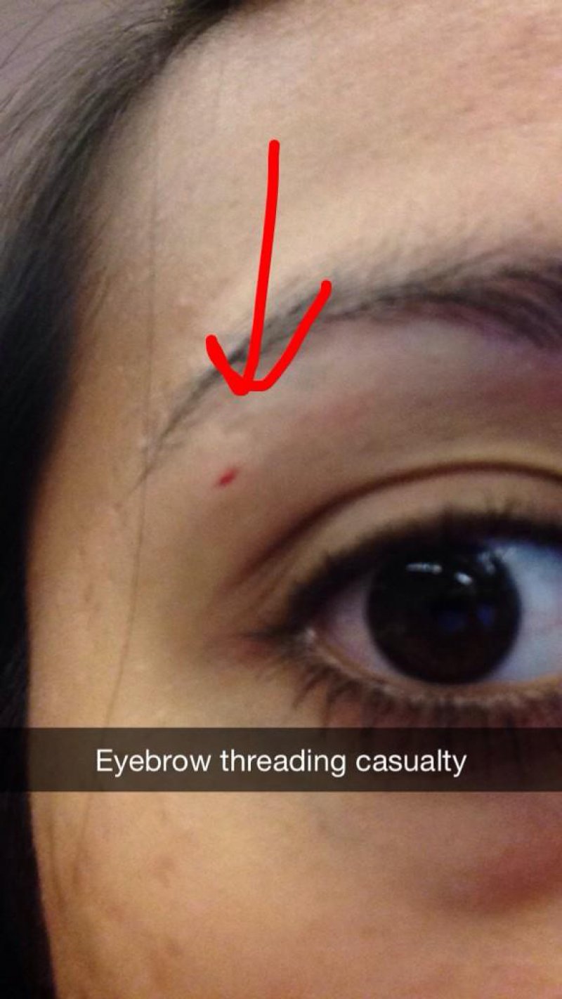 Eyebrow Threading Accident-15 Things That Will Make You Cringe If You're A Girl