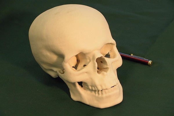 Medical models-Cool Things To Make With 3d Printer