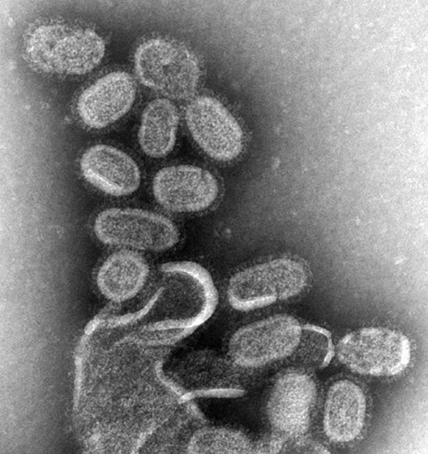 Influenza-Incurable Diseases