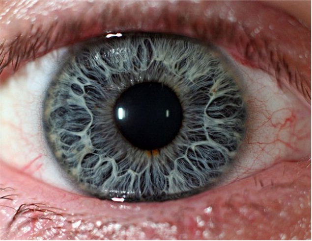 Windows to the Soul-Extreme Close Ups Of The Human Eye