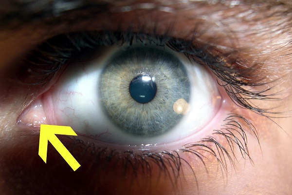 Third eyelid-Vestigial Human Body Parts You Didn't Know
