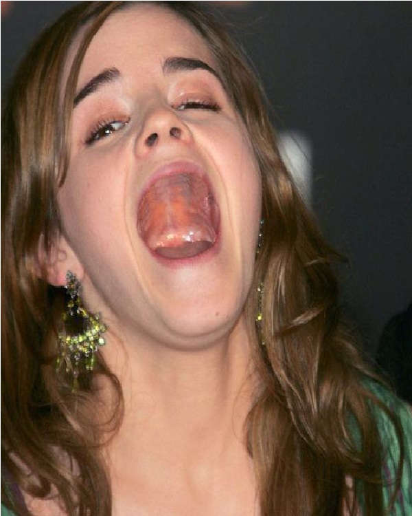 Emma Watson-Celebs Without Teeth