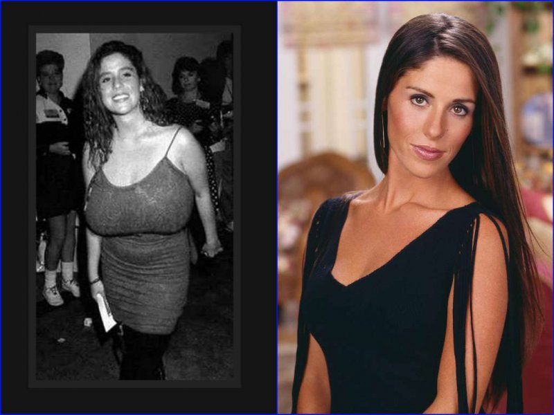 Soleil Moon Frye Before And After Breast Reduction Surgery-15 Celebrities Who Had Breast Reduction Surgeries