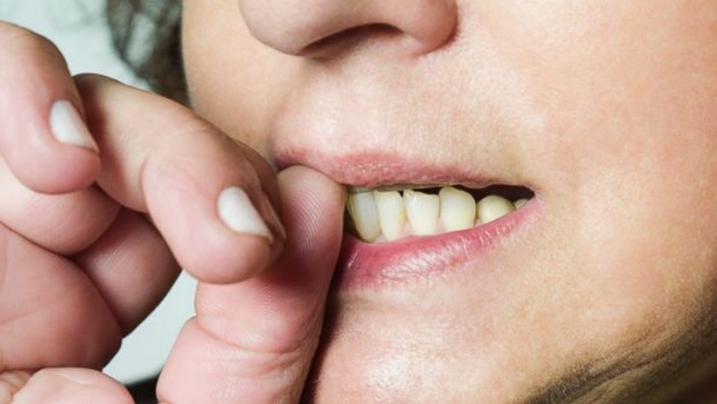 Nail-biting Transfers Germs Into Your Mouth-Here's What Nail Biting Can Do To You