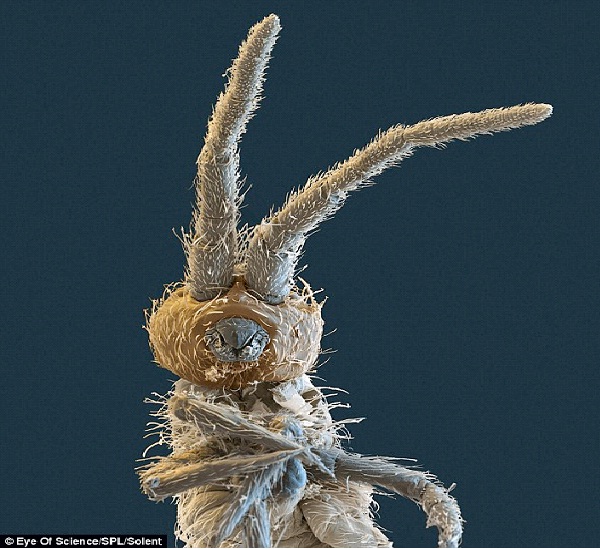 Springtail-Ugliest Bugs