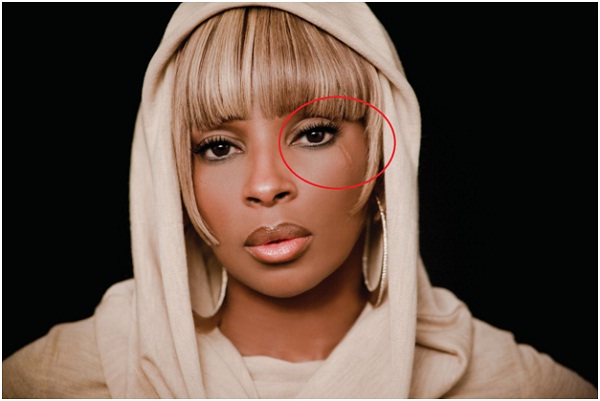 Mary J. Blige - Eye Scar-12 Celebrities With Scars And Deformities