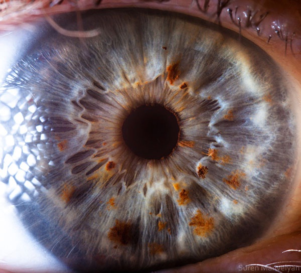 Color Myriads-Extreme Close Ups Of The Human Eye