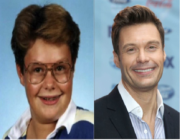 Ryan Seacrest-12 Celebrities Who Looked Ugly When They Were Kids
