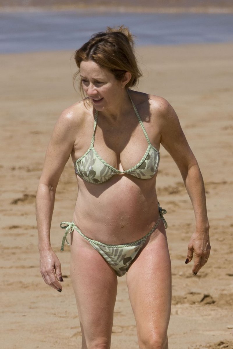 Patricia Heaton-15 Celebrities With Strange Physical Flaws You Probably Don't Know About