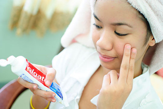 A Surprise Acne Remedy-15 Unusual Uses For Toothpaste