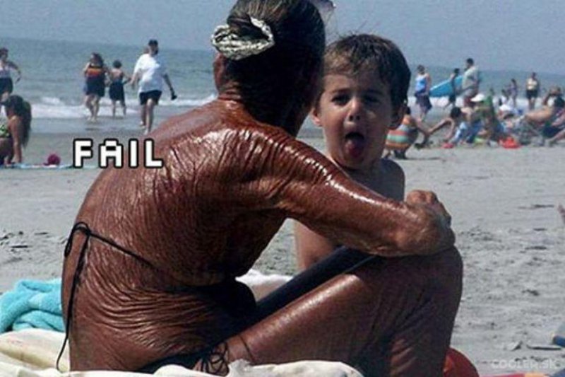 Sunscreen is not Her Friend-18 Hilarious Beach Fails That Will Make You Laugh Out Loud